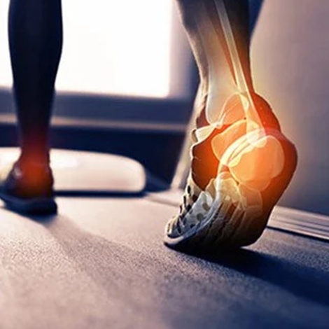 Sports Injury Management