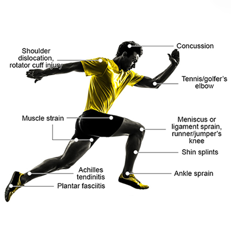 Sports Injury Management