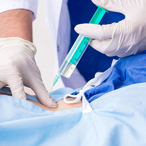 Regenerative Therapy